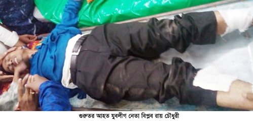 হবিগঞ্জ জেলা যুবলীগের যুগ্ম-সাধারণ সম্পাদক দুর্বৃত্তদের হামলায় আহত হবিগঞ্জ জেলা যুবলীগের যুগ্ম-সাধারণ সম্পাদক দুর্বৃত্তদের হামলায় আহত