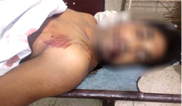 লিফটে চাপা পড়ে মৃত্যু লিফটে চাপা পড়ে মৃত্যু
