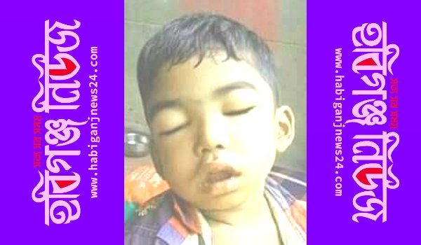চুনারুঘাটে করোনায় আক্রান্ত হওয়া শিশুর মৃত্যু চুনারুঘাটে করোনায় আক্রান্ত হওয়া শিশুর মৃত্যু