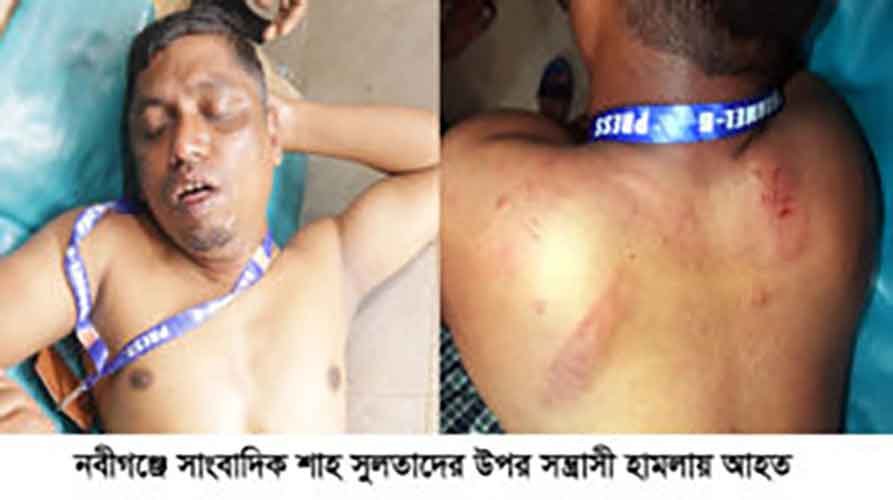 নবীগঞ্জে অনিয়মের সংবাদ প্রচারের জেরে সাংবাদিকের উপর হামলা নবীগঞ্জে অনিয়মের সংবাদ প্রচারের জেরে সাংবাদিকের উপর হামলা