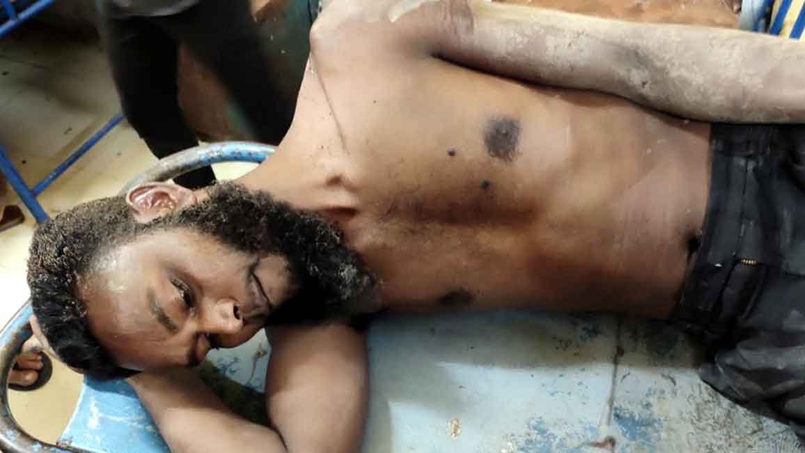 শহরে বিদ্যুতস্পৃষ্ট হয়ে আহত হয়েছে এক শ্রমিক শহরে-বিদ্যুতস্পৃষ্ট-হয়ে-আহত-হয়েছে-এক-শ্রমিক