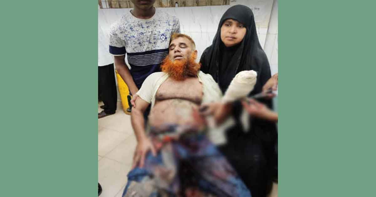 হবিগঞ্জ সদরে ৪ সহোদরের হামলায় অপর ভাই আহত হবিগঞ্জ সদরে ৪ সহোদরের হামলায় অপর ভাই আহত