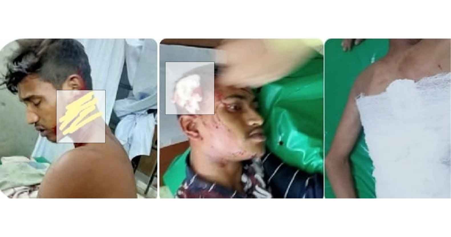 চুনারুঘাটে কিশোর গ্যাংয়ের হামলায় আহত ৩ Habiganj-News-চুনারুঘাটে-কিশোর-গ্যাংয়ের-হামলায়-আহত-৩