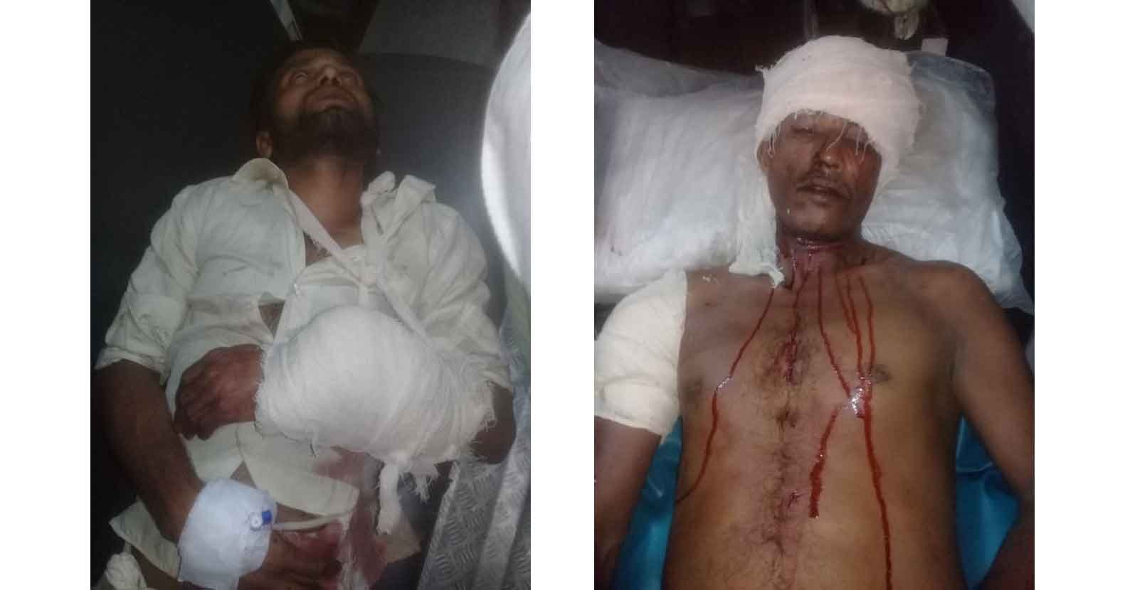 বাহুবলে মেয়ের জামাইর হামলায় শশুরসহ আহত ৩ বাহুবলে মেয়ের জামাইর হামলায় শশুরসহ আহত ৩