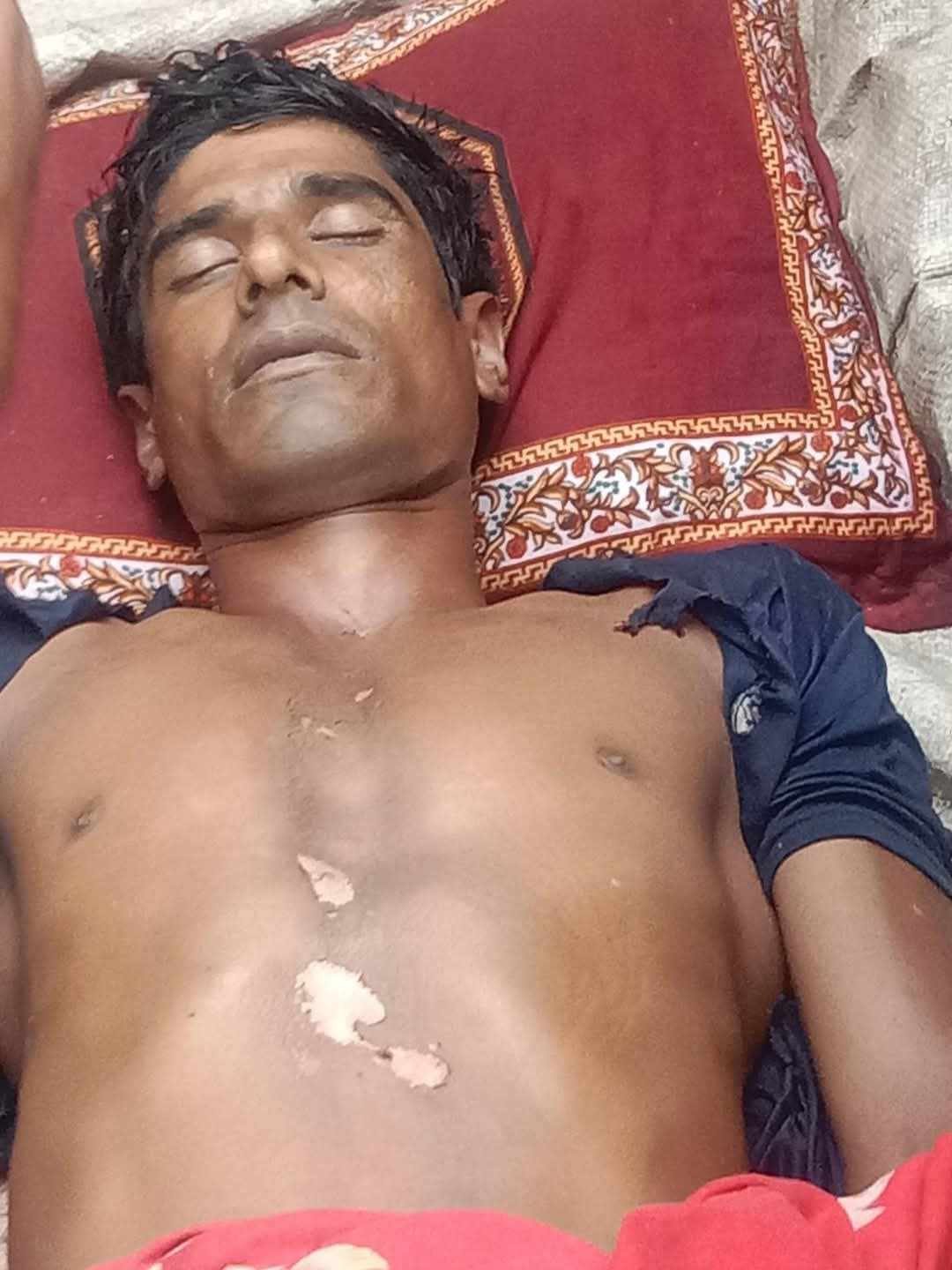 চুনারুঘাটে বজ্রপাতে এক কৃষকের মৃত্যু চুনারুঘাটে বজ্রপাতে এক কৃষকের মৃত্যু